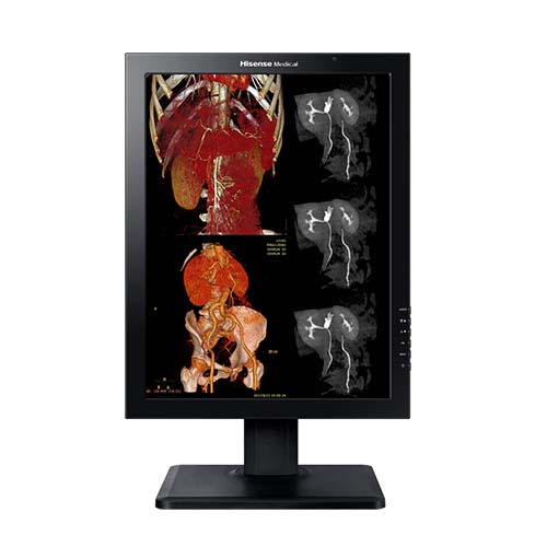 Monitor médico Hisense HMD2C21A