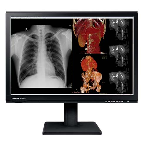 Monitor médico Hisense HMD4C27S