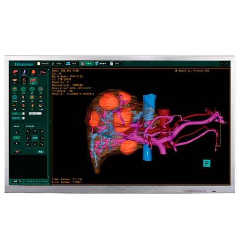 Monitor quirúrgico Hisense HME8C55S