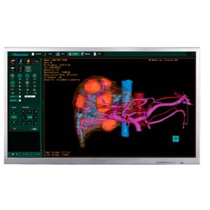 Monitor quirúrgico Hisense HME8C58